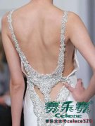 女人们 当心肥胖引起骨关节炎